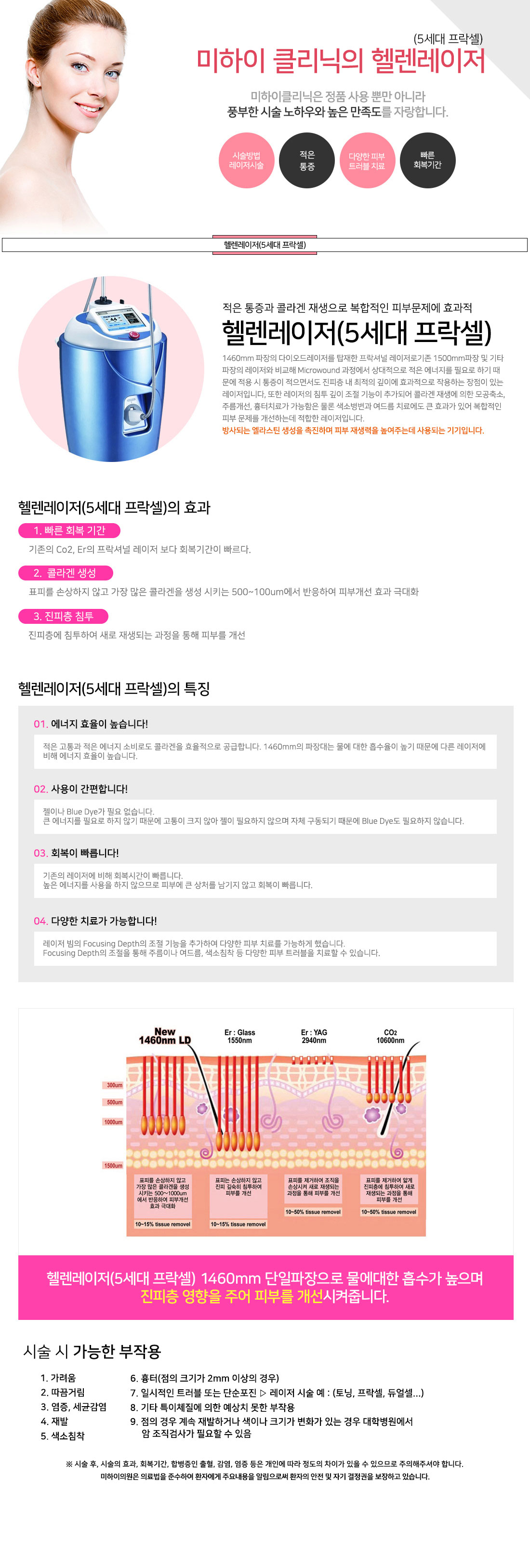 제모레이저